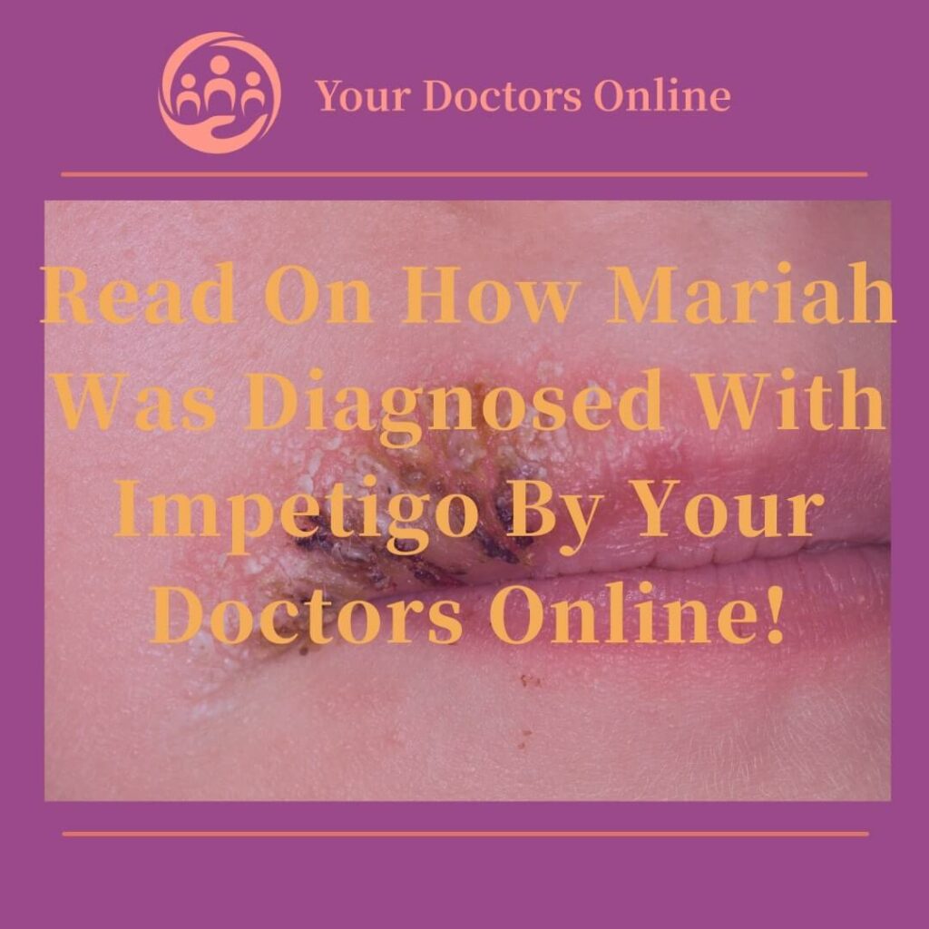 Read On How Mariah Was Diagnosed With Impetigo By Your Doctors Online!